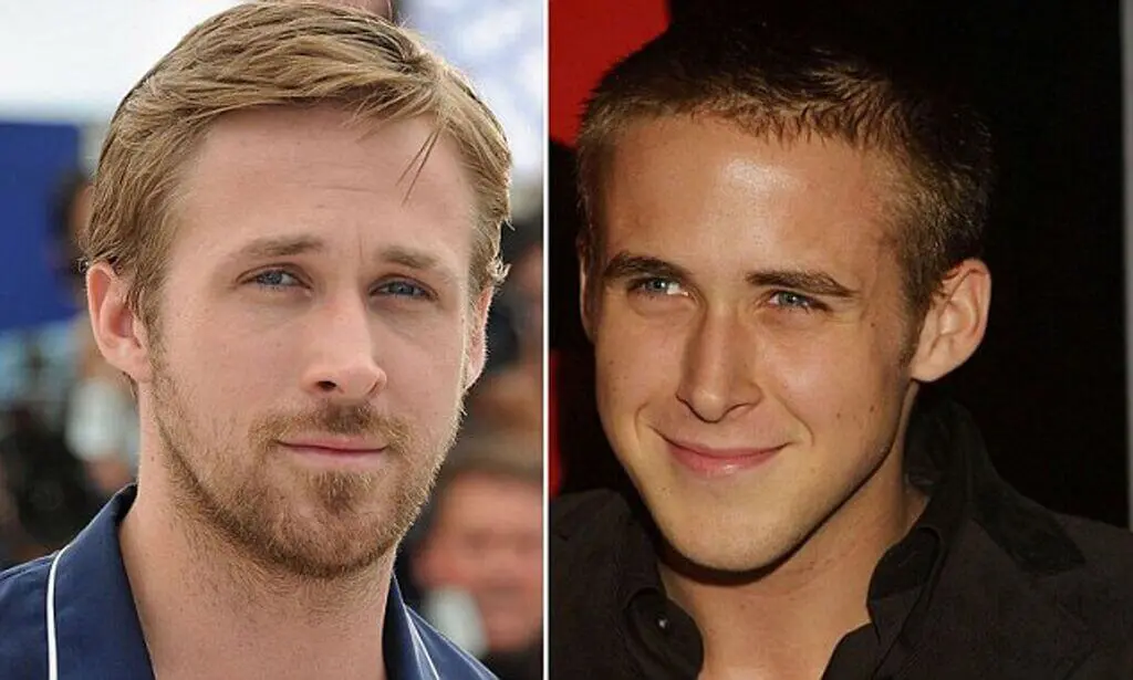 Male Celebrities with Nose Jobs