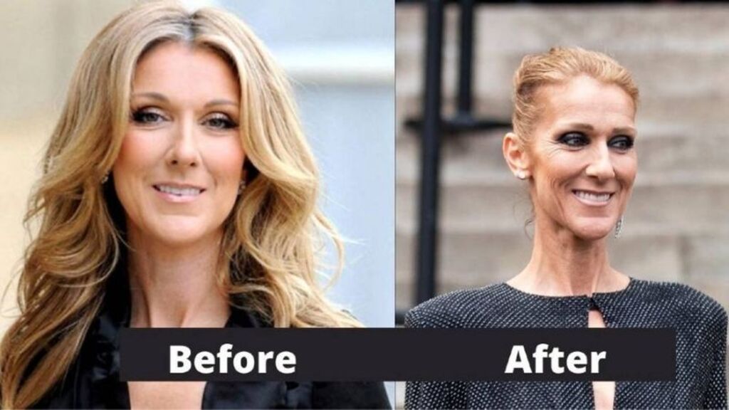 celine dion weight loss