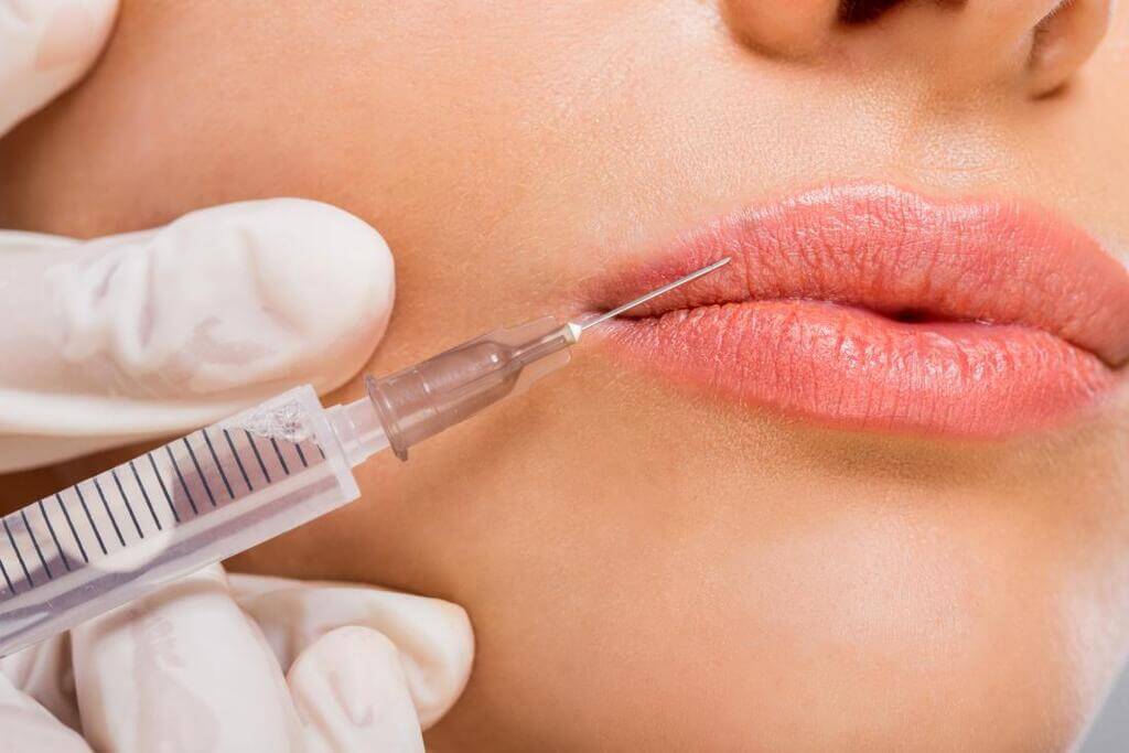 Longevity and Maintenance of Face Fillers and Injectables